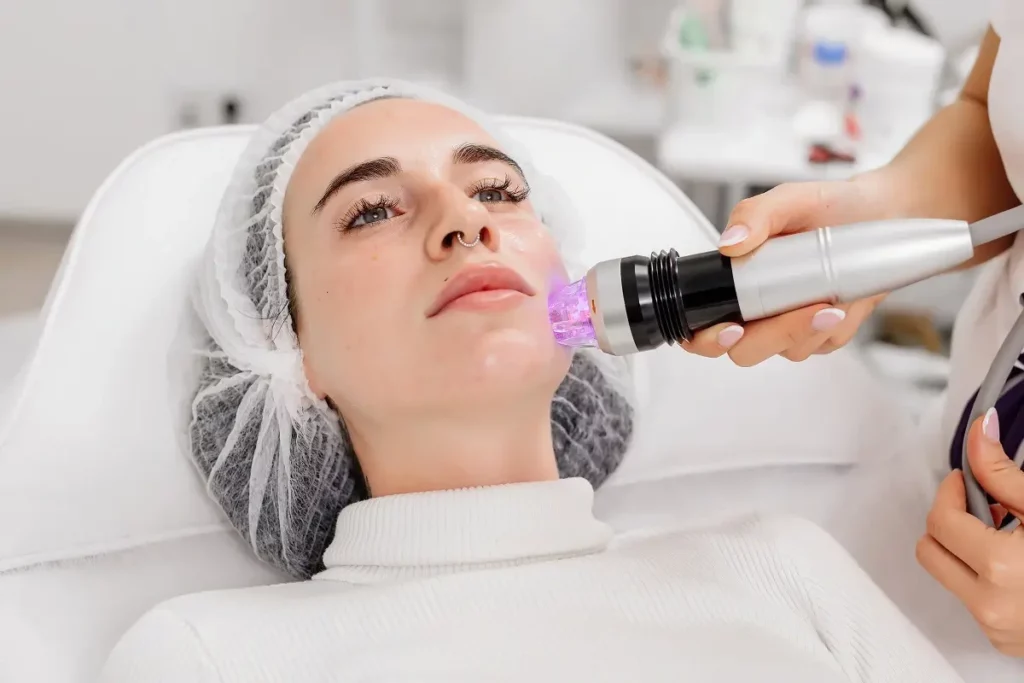 RF Microneedling in New York USA