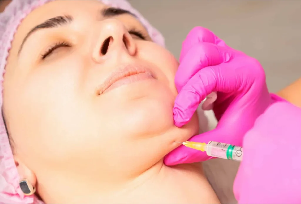 Kybella Treatment in New York, NY by Refined Glow