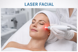 laser facial